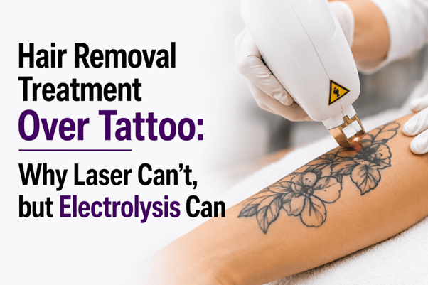 Hair Removal Treatment Over Tattoo: Why Laser Can’t, but Electrolysis Can